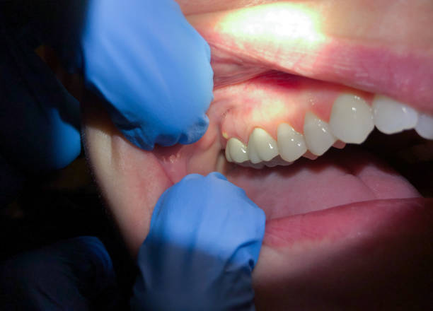Best Emergency Dental Surgery in Worthington, KY