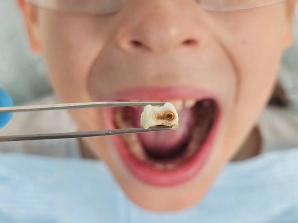 Best Pediatric Emergency Dentist in Worthington, KY