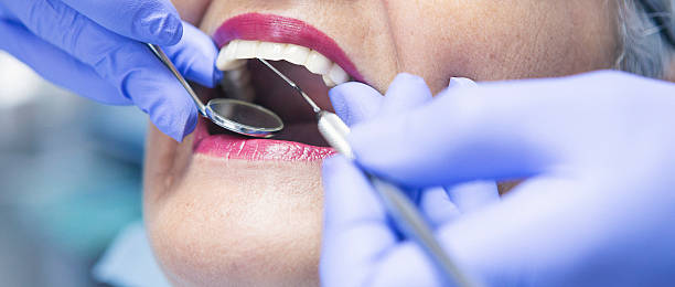 Best Emergency Root Canal Treatment in Worthington, KY
